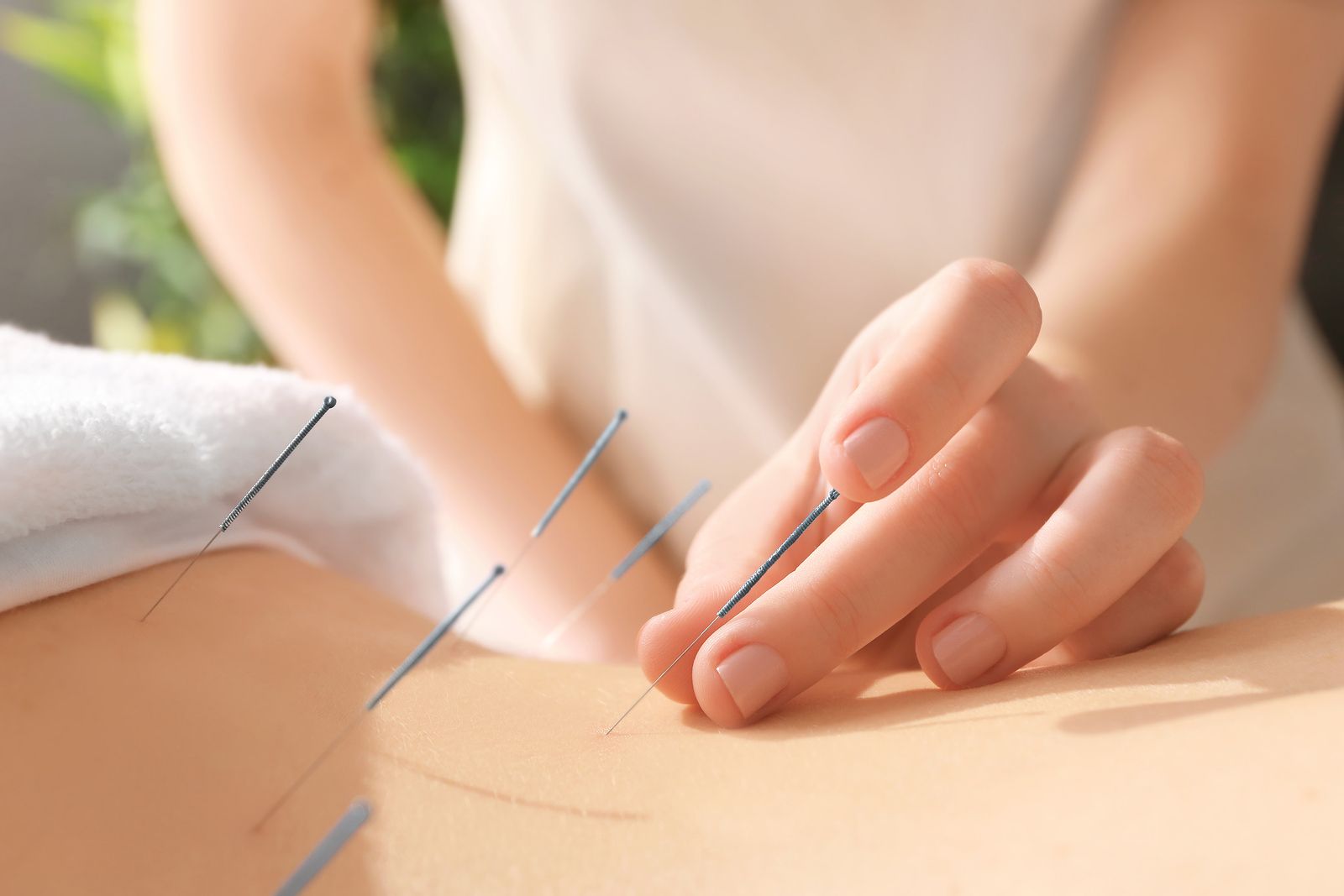 Acupuntura_beneficios
